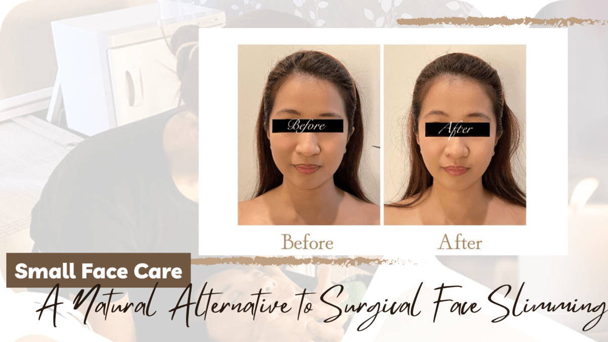 Small Face Care: A Natural Alternative to Surgical Face Slimming